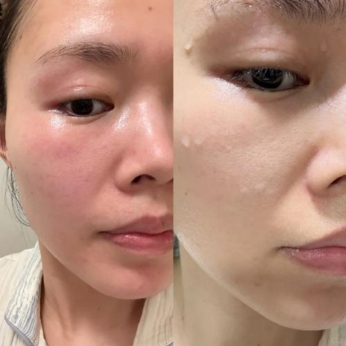 成分党速看：水悠季极光水的这些有效成分你都知道吗？