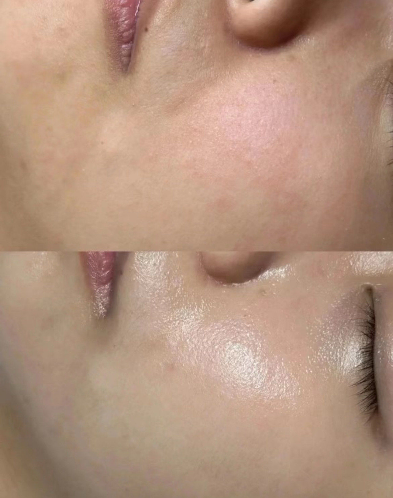 敏肌也放心冲的水悠季极光水：温和补水长效保湿还提亮