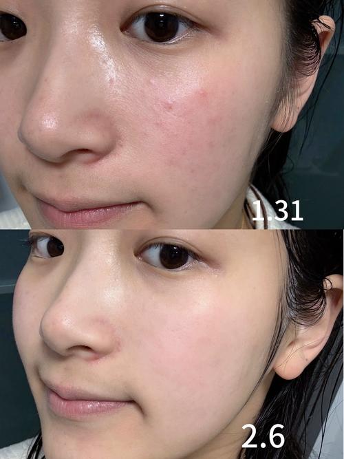 油皮洁面选它准没错！水优季洁面乳温和清洁不紧绷，控油保湿超省心