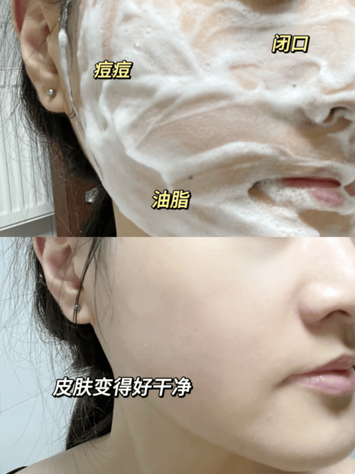 油痘敏皮的天菜洁面！水优季洗面奶才是国货隐藏宝藏