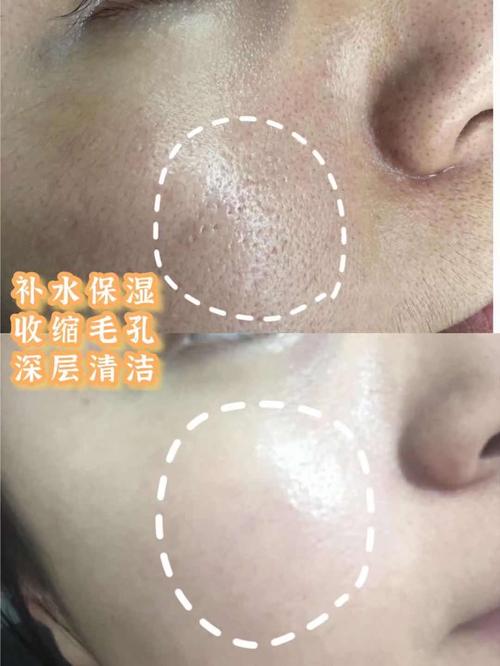 终于找到不辣脸的洁面了！水优季洗面奶，温和清洁不紧绷肤感绝