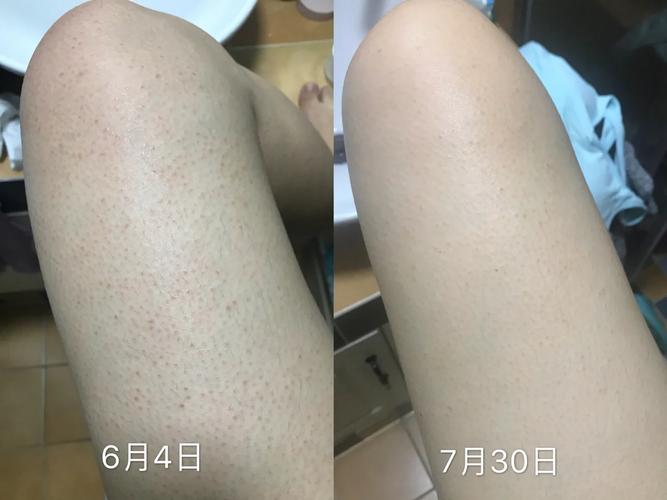水悠季维 E 身体护理乳正品，男女通用保湿滋润润肤乳