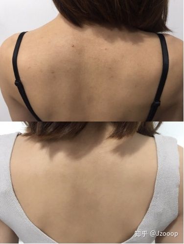 水悠季维 E 修护身体乳，修护干燥泛红敏感肌屏障身体乳