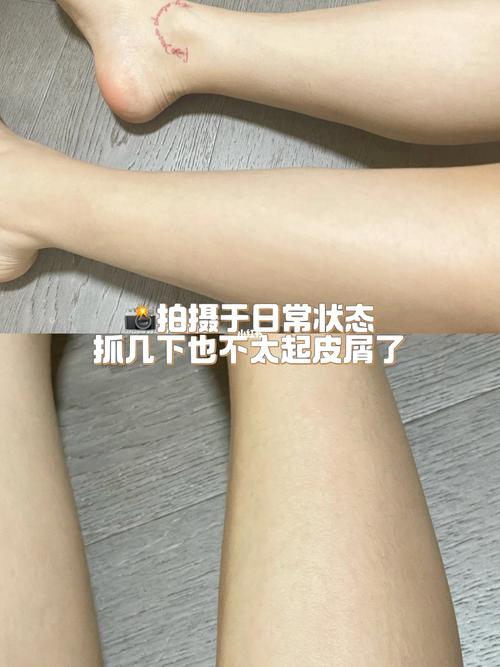 敏感肌必入水悠季维 E 修护乳，秋冬保湿舒缓身体护理乳