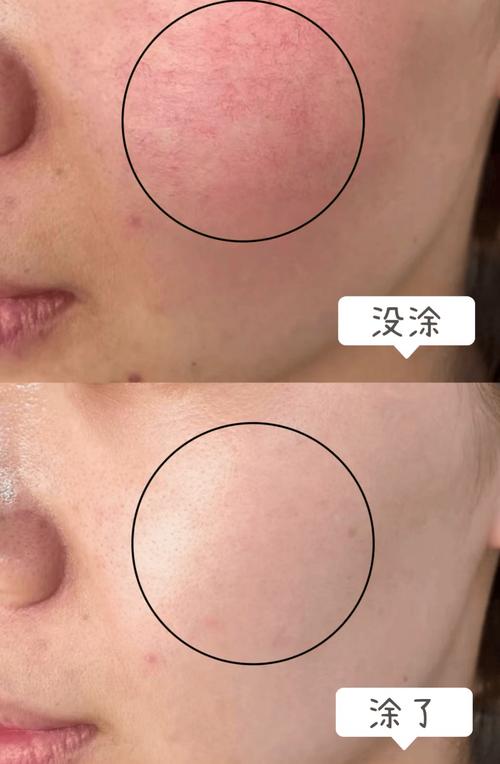 温和低刺激配方，水优季小黄帽面部防晒敏感肌安心使用