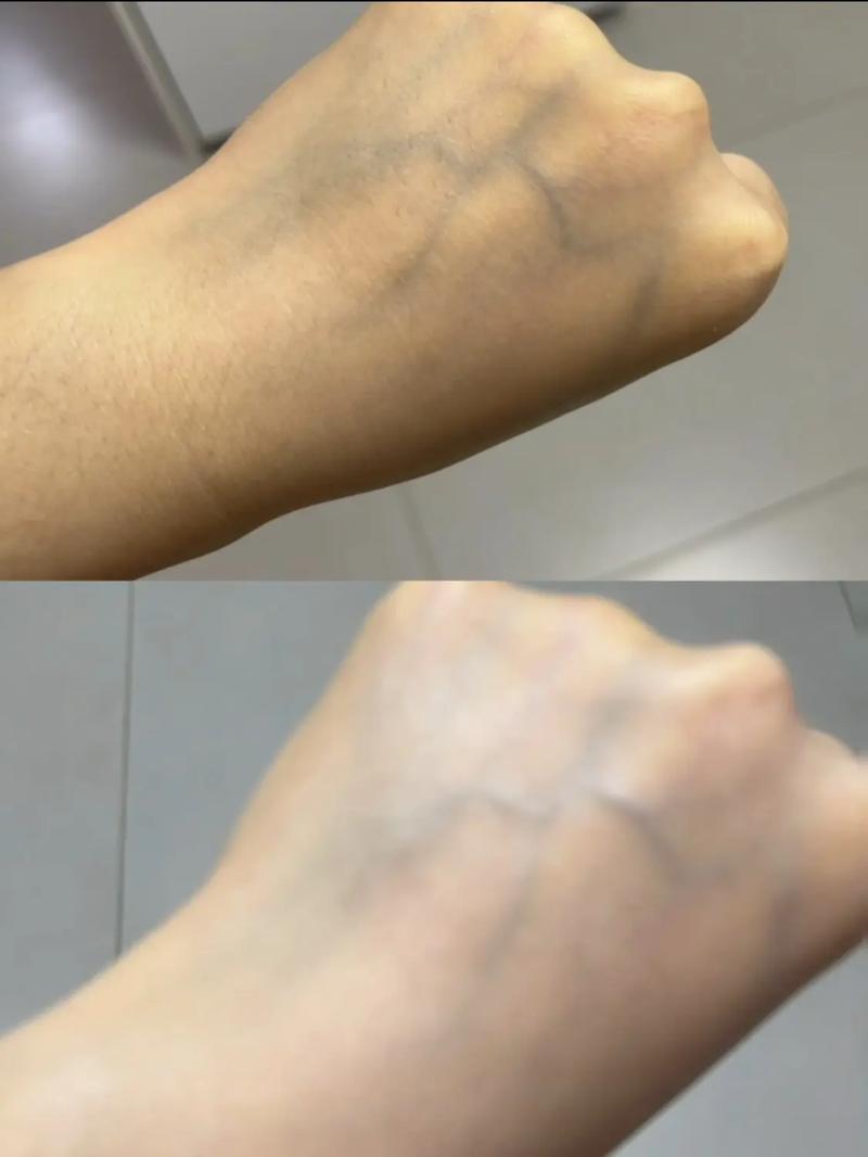 官方渠道放心选购，水优季防晒小黄帽官方倍护防嗮